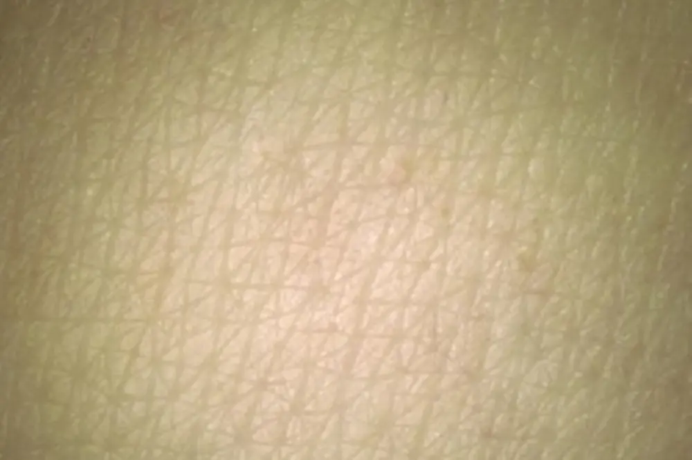 Detalhe microscópico da pele peluda